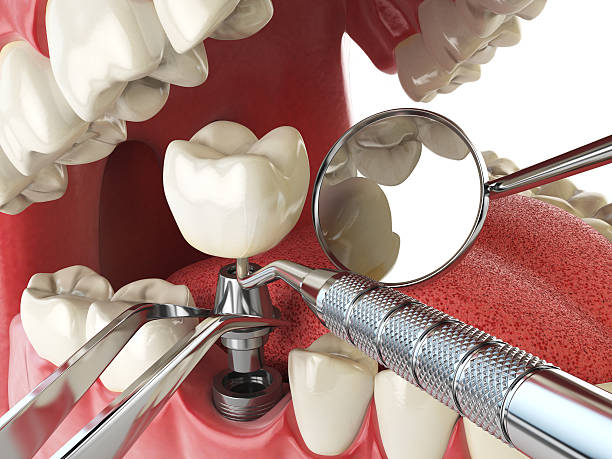 Best Weekend Emergency Dentist in Webster Groves, MO